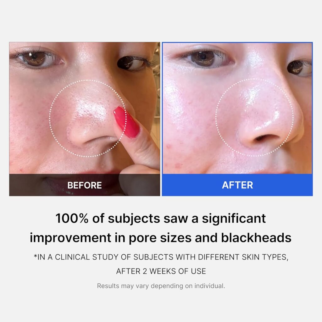 antes-despues-1024x1024 Zero Pore Pad 2.0 155g (70 Pads)