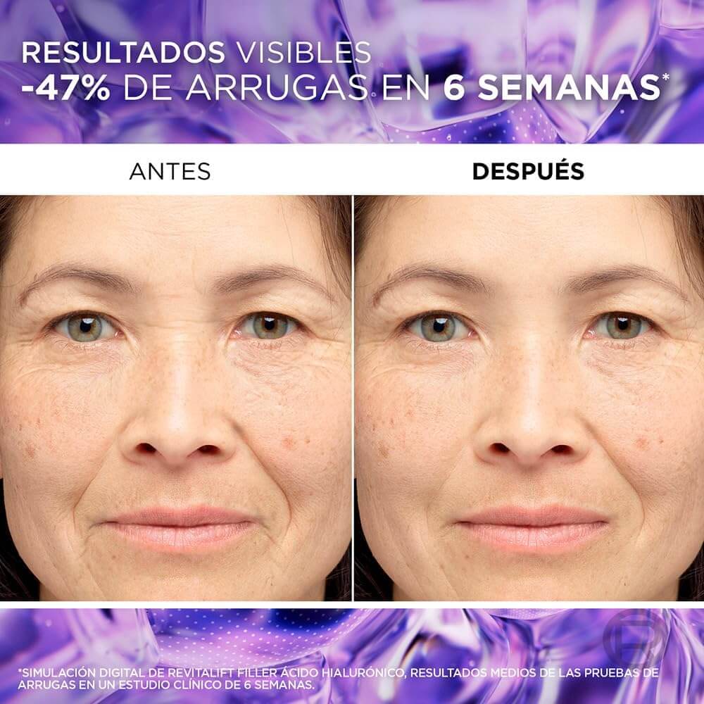 antes-y-despues-3 L'Oréal Paris Sérum Antiedad Revitalift Filler con Ácido Hialurónico