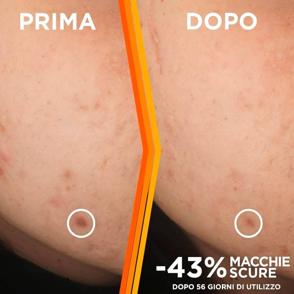 antes-y-despues-1024x1024 Opiniones GARNIER Vitamina C Glow Booster Serum 30 ml-¿ Funciona?